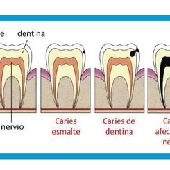 Clinica Dental Canet odontología conservadora 2