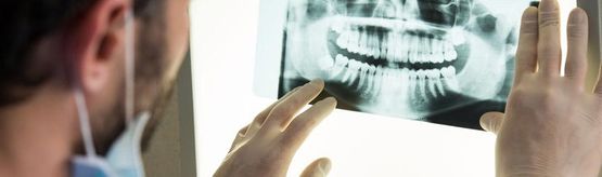 Clinica Dental Canet rayos x de dientes