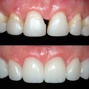 Clinica Dental Canet odontología estética 3