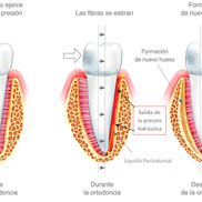 Clinica Dental Canet Ortodoncia 2