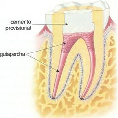 Clinica Dental Canet odontología conservadora 1