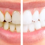 Clinica Dental Canet odontología estética 2