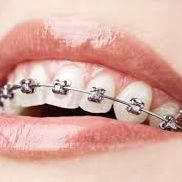 Clinica Dental Canet Ortodoncia 3