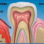 Clinica Dental Canet Periodoncia 2